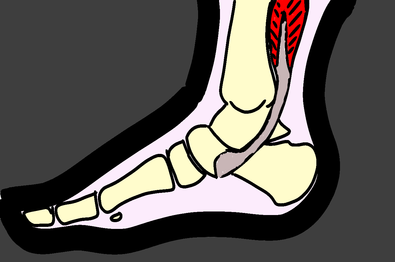 image du tendon du tibial post
